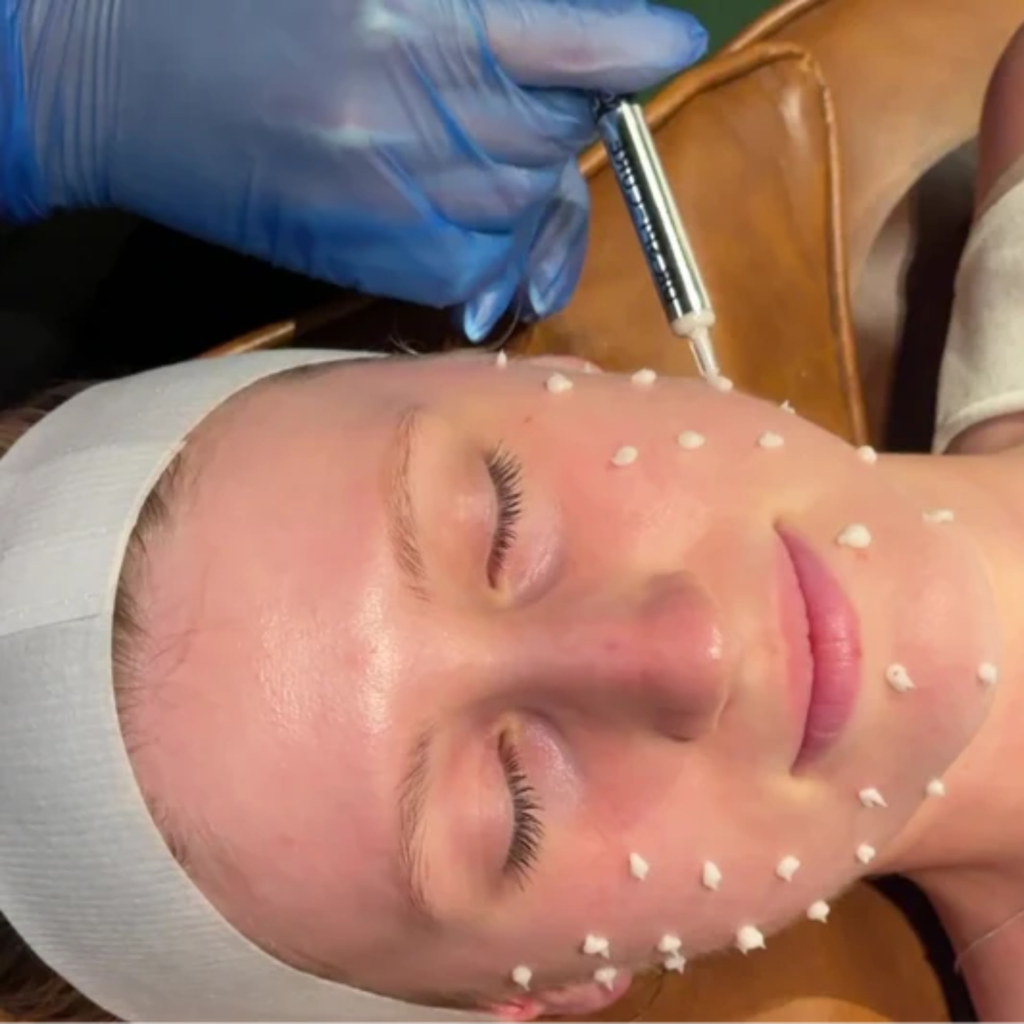 Low molecular weight PDRN skincare product example